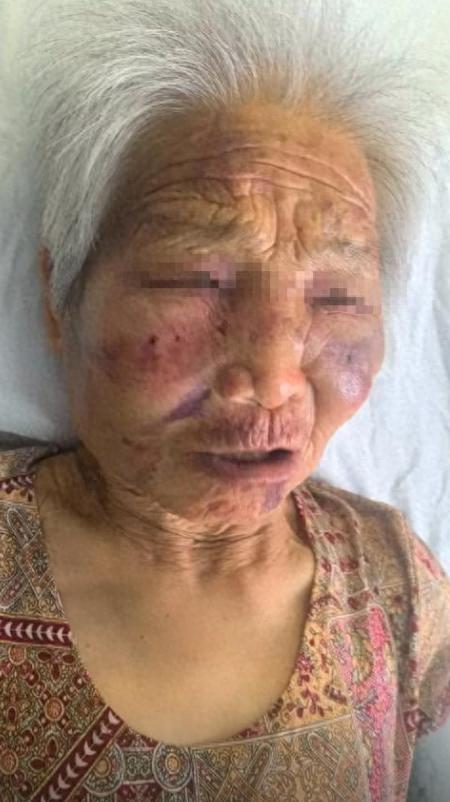 mk体育入口-山西养老院暴打85岁老人:打人者真容曝光,身份不一般,官方回应